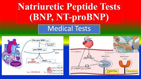 Natriuretic Peptide Tests (BNP, NT